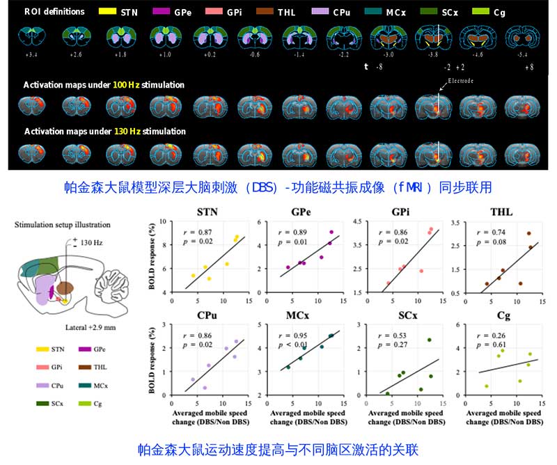 北京大学段小洁课题组及合作者在MRI兼容神经电极及DBS-fMRI联用揭示DBS对大脑调制效应方面取得重要进展-第2张图片-C9联盟
