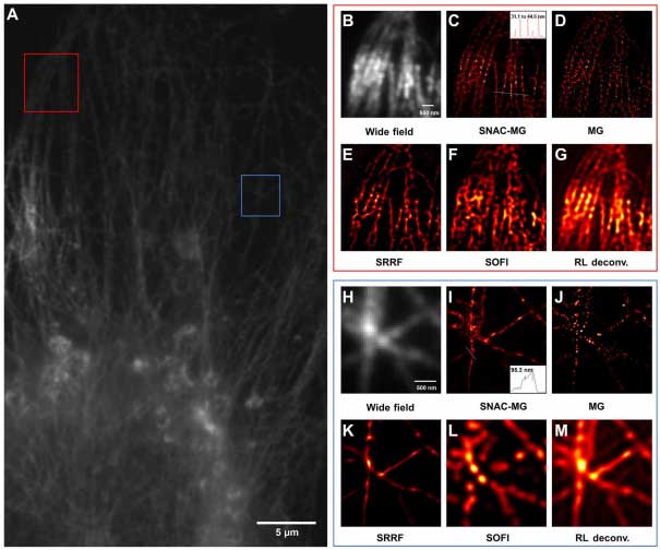 北京大学极端光学研究团队实现量子相干控制超分辨荧光宽场显微成像-第1张图片-C9联盟