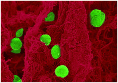 浙大周民、孙毅团队在Science Advances报道：工程化活性微藻改善肿瘤乏氧微环境，提高肿瘤联合治疗效果